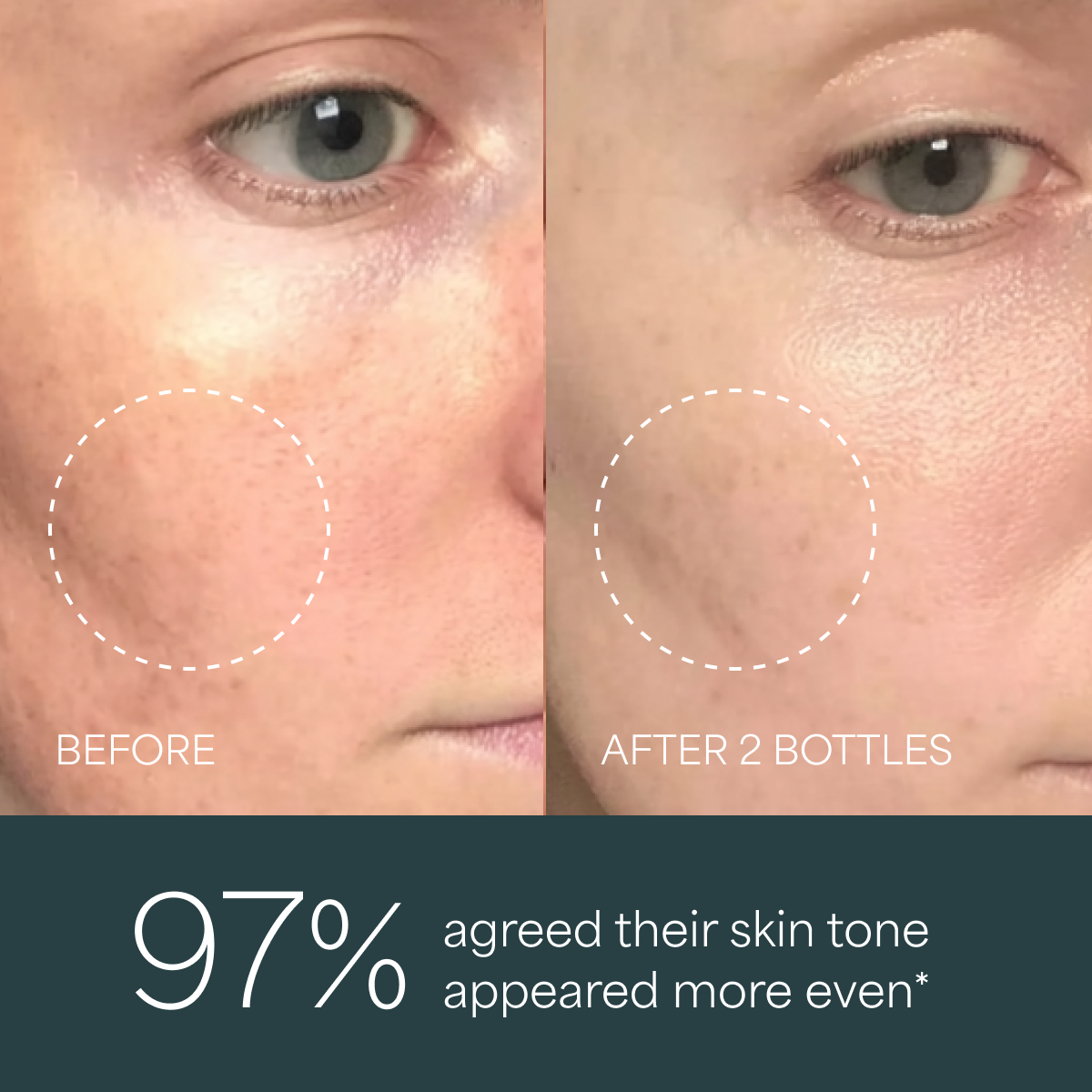 Derma Botanica Overnight Repair Serum before and after comparison of skin tone with text indicating improvement.