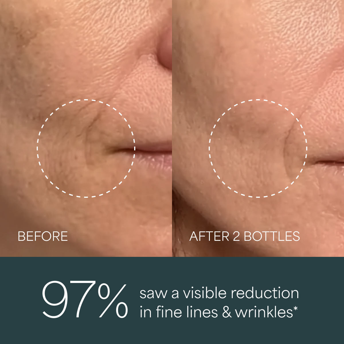 Derma Botanica Overnight Retinol Serum before and after comparison of fine lines and wrinkles on skin with text indicating visible reduction.