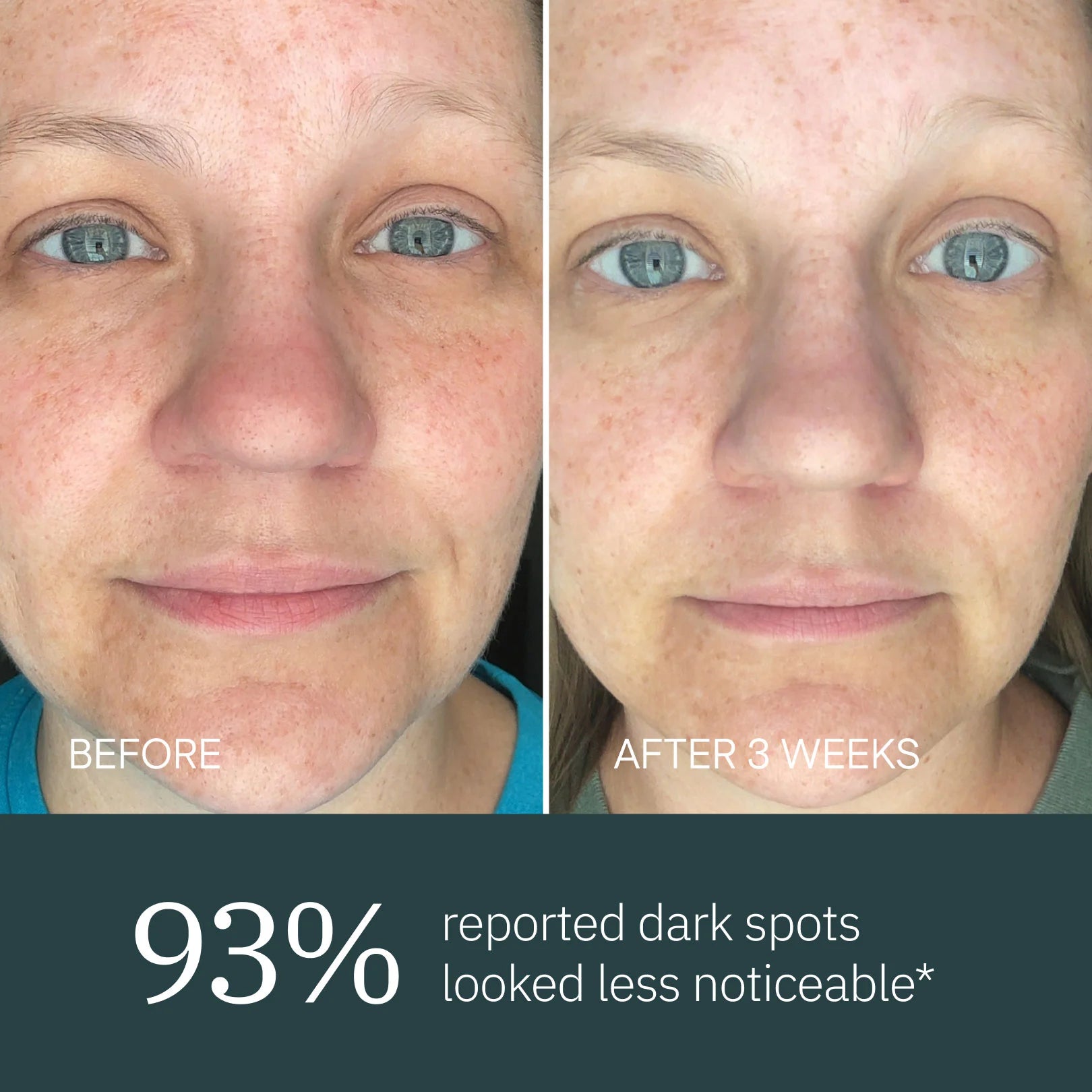 Overnight Repair Serum