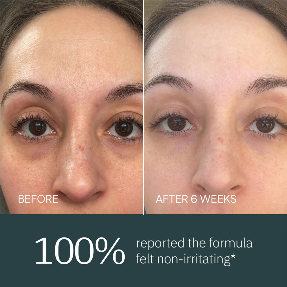 Overnight Retinol Serum