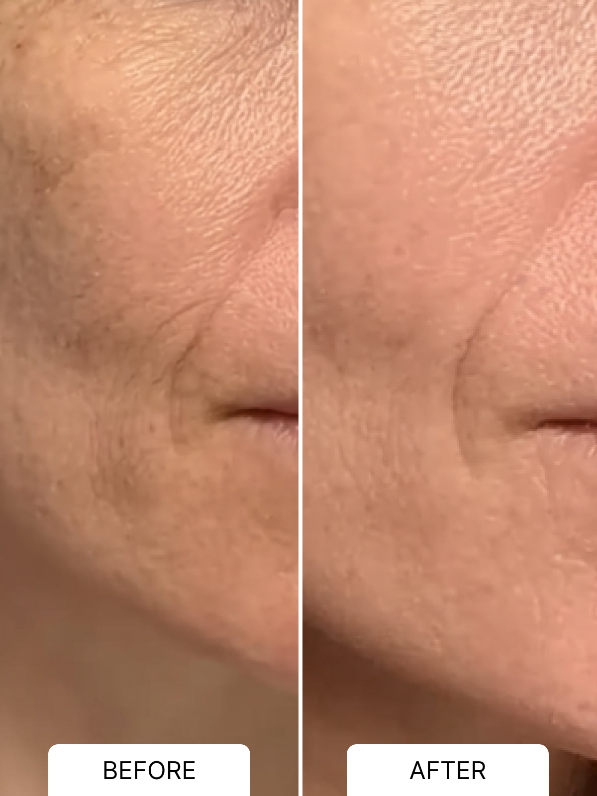 Overnight Retinol Serum