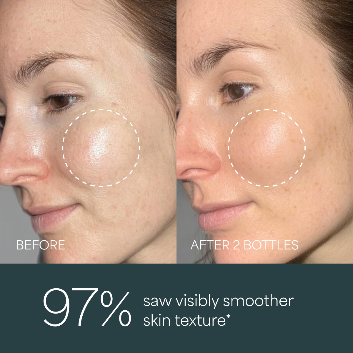 Derma Botanica Overnight Retinol Serum before and after comparison of skin texture, with a visible improvement after using the product.