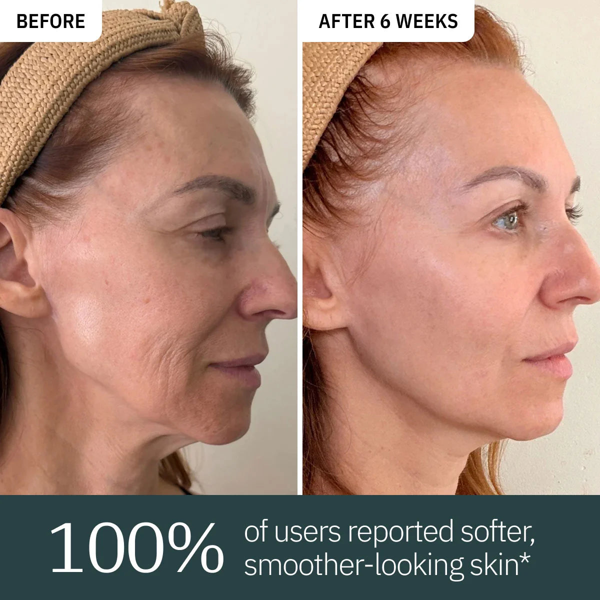 Overnight Retinol Serum