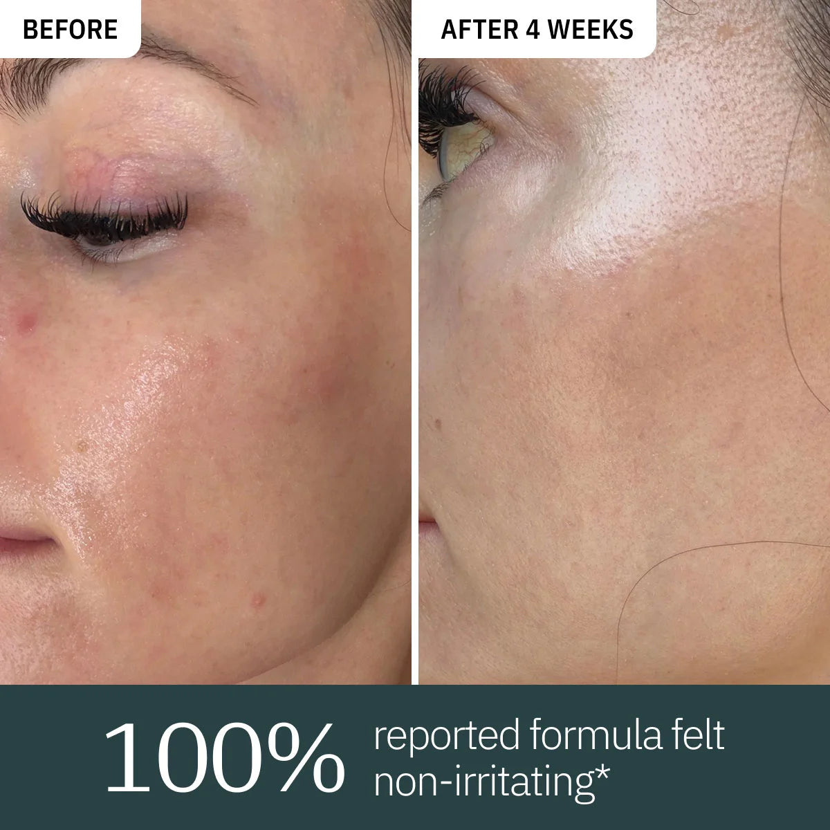 Overnight Retinol Serum
