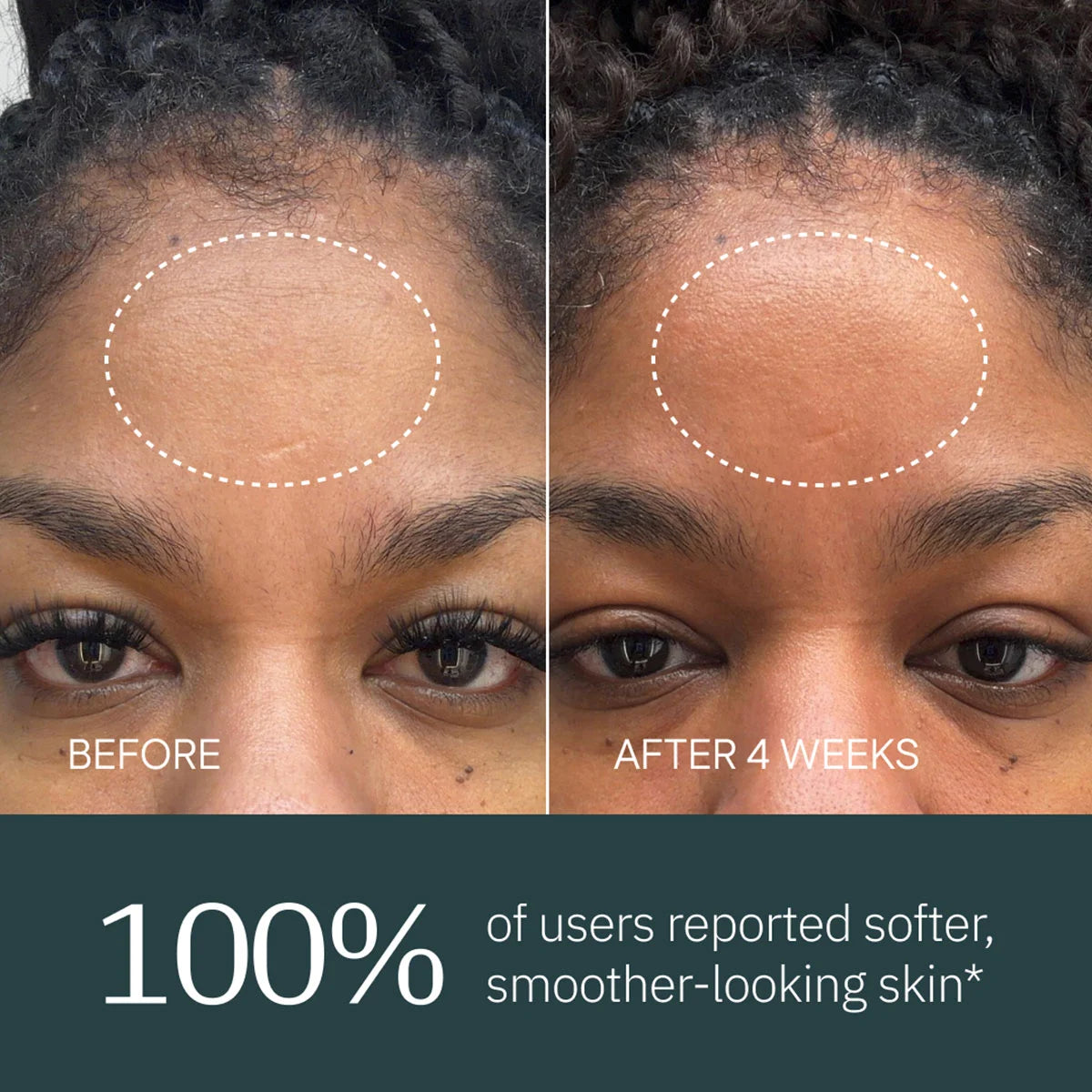 Overnight Retinol Serum